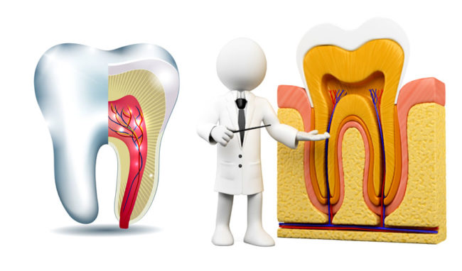 root-canal-treatment-in-rt-nagar